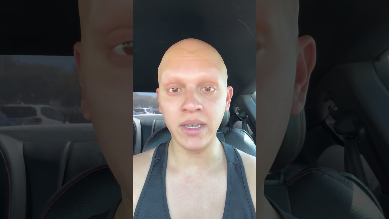 ROAST ME IN THE COMMENTS #comedy #funny #alopecia #roasts