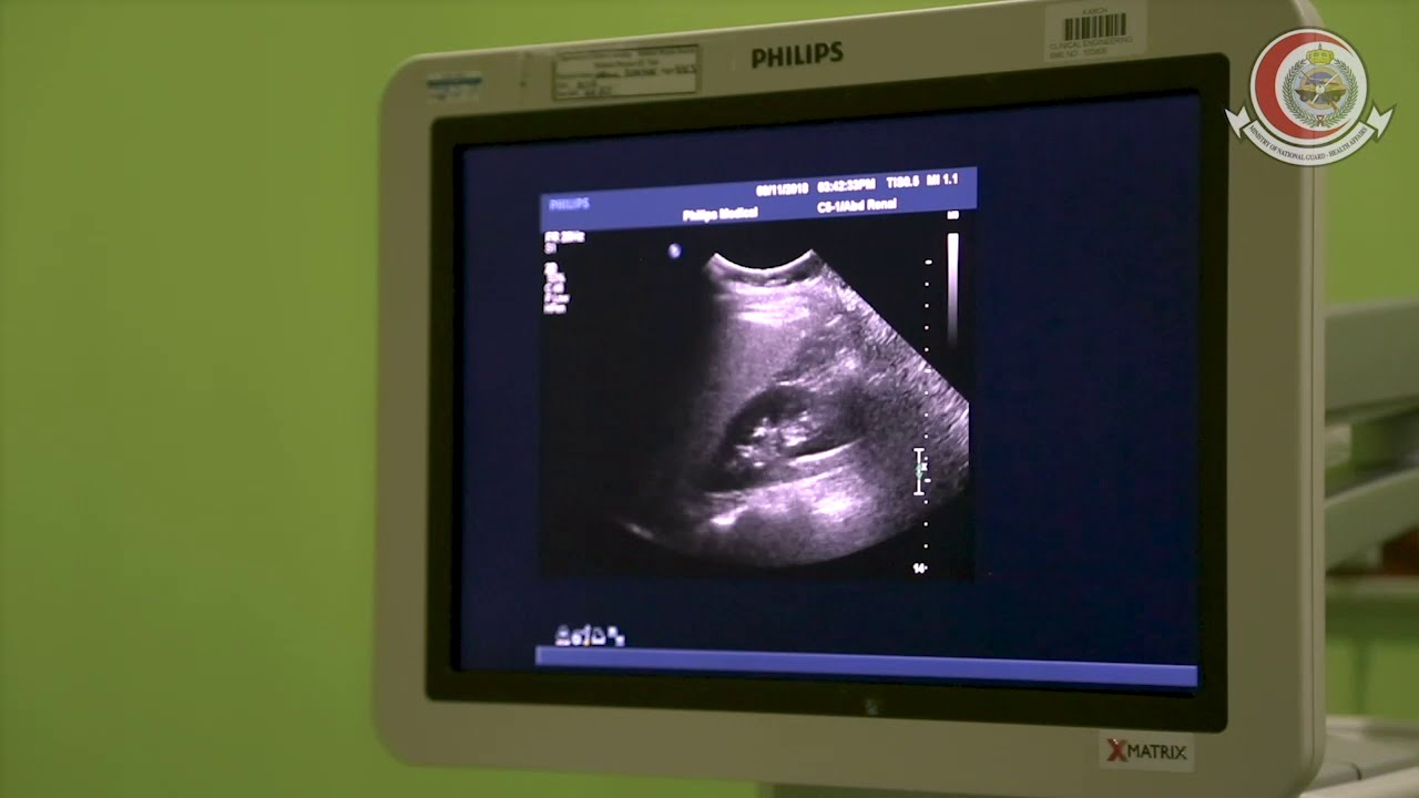 الأشعة الصوتية