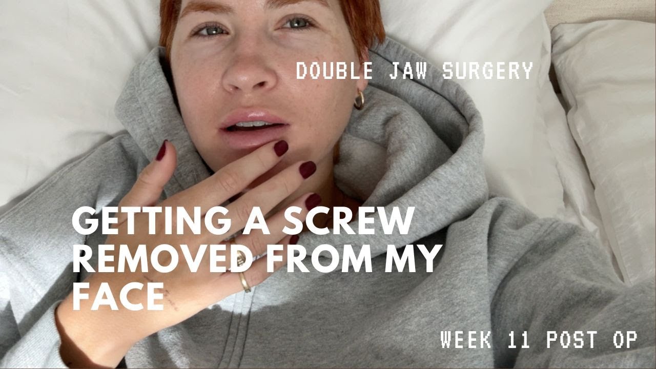 Removing a Screw From my Face