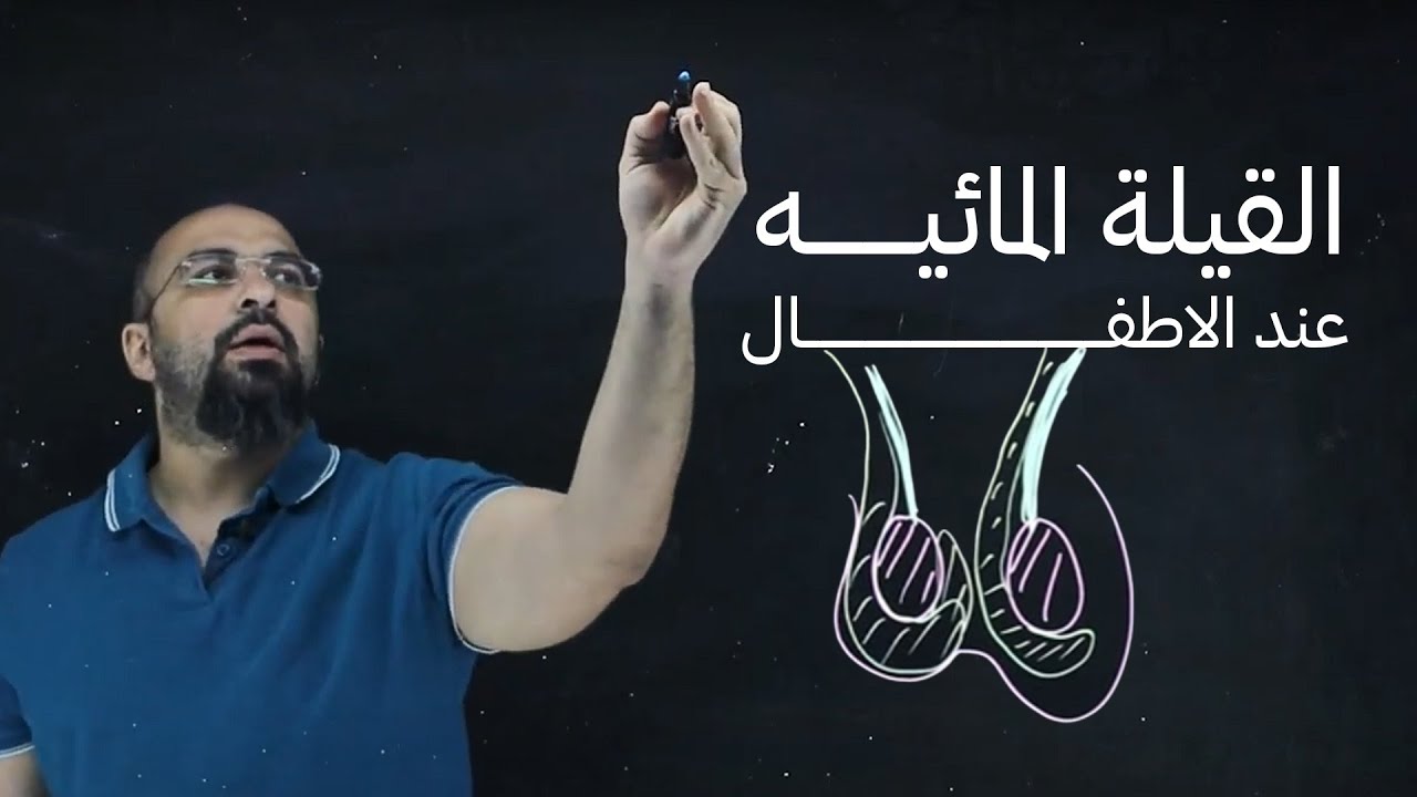 القيلة المائيه | كيس المياه على الخصيه | دكتور خالد صلاح | استشاري جراحة حديثي الولادة |