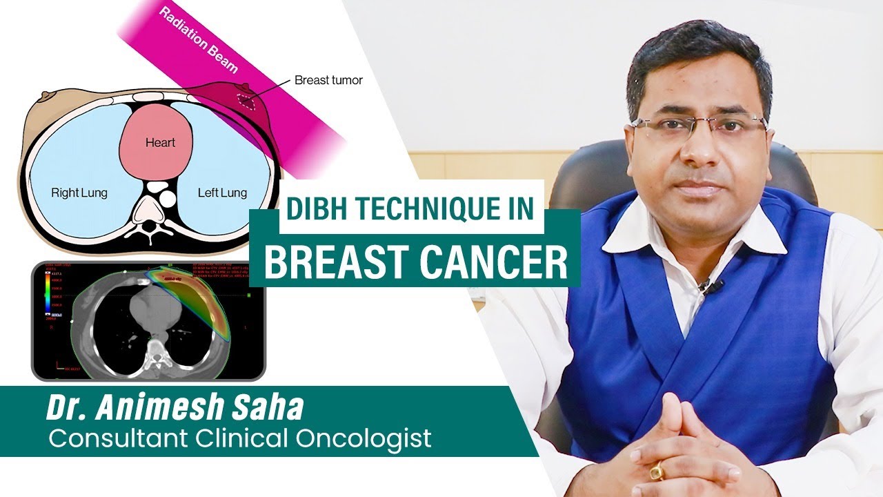 The new technique for protecting heart for left sided breast cancer patient’s radiotherapy