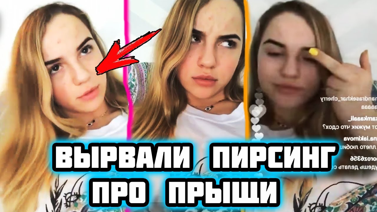 МАРЬЯНА: СПАСИТЕ ОТ МОИХ ПРЫЩЕЙ! МНЕ ВЫРВАЛИ ПИРСИНГ!