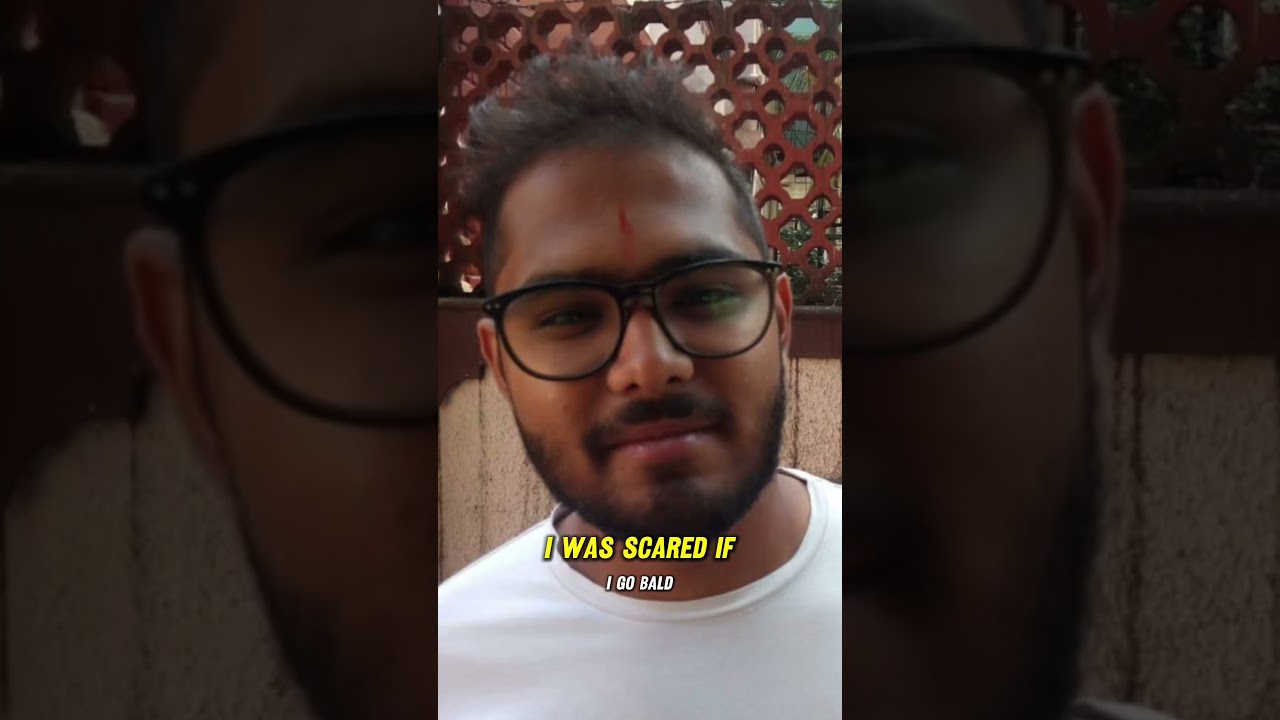 Going Bald In 20&rsquo;s In INDIA 🇮🇳 #Bald #india #Balding