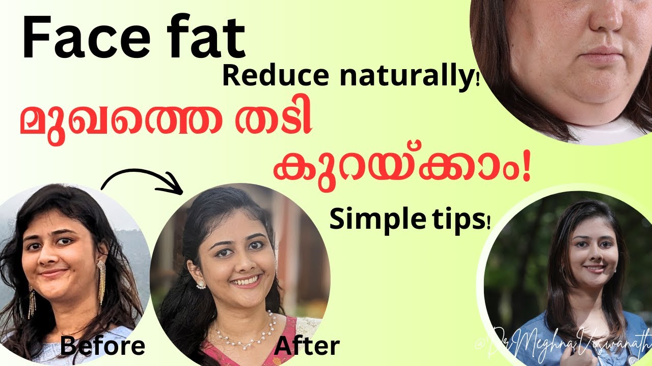 മുഖത്തെ തടി കുറയ്ക്കാം! Reduce face fat easy tips!!