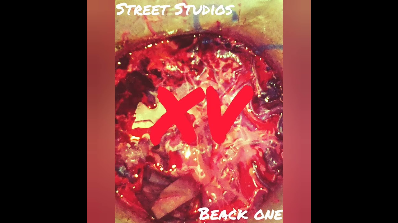 2°- El BEACK ONE // Beack One // Street Studios Récords //(KLAN de AGS) Prod. Mr.B AUDIO OFICIAL.