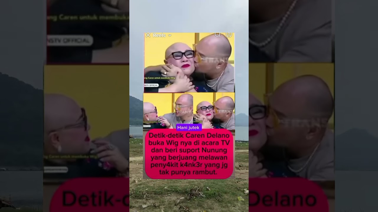 Caren Delano buka wig nya dan beri support untuk Nunung yg berjuang melawan kanker 
