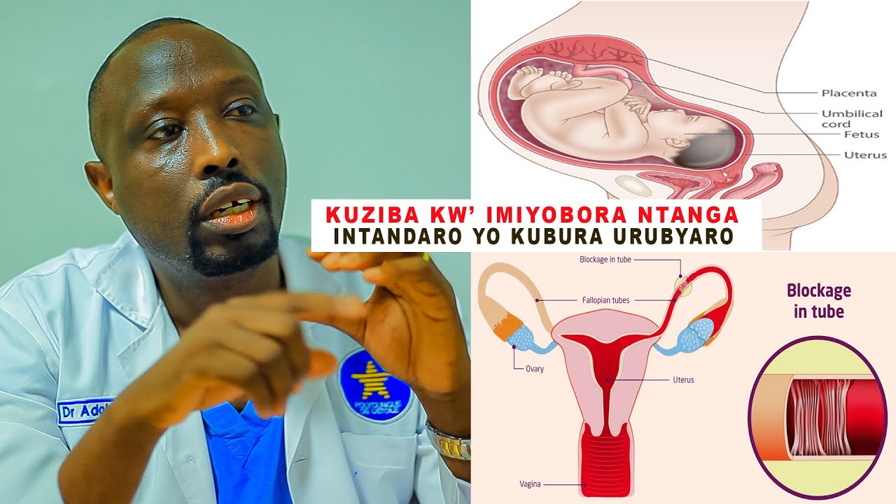 IKIBAZO CYA GUTERA KUBURA URUBYARO, KUZIBA KW'IMIYOBORANTANGA