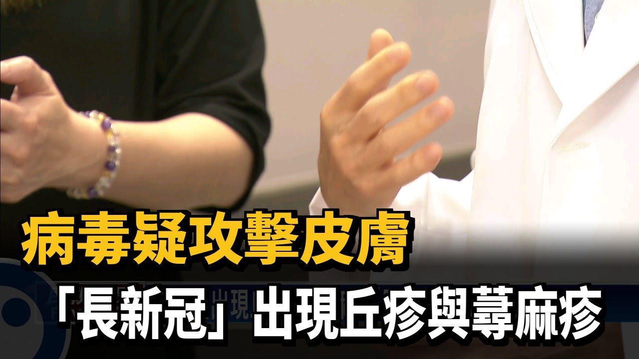 病毒疑攻擊皮膚 「長新冠」出現丘疹與蕁麻疹－民視台語新聞