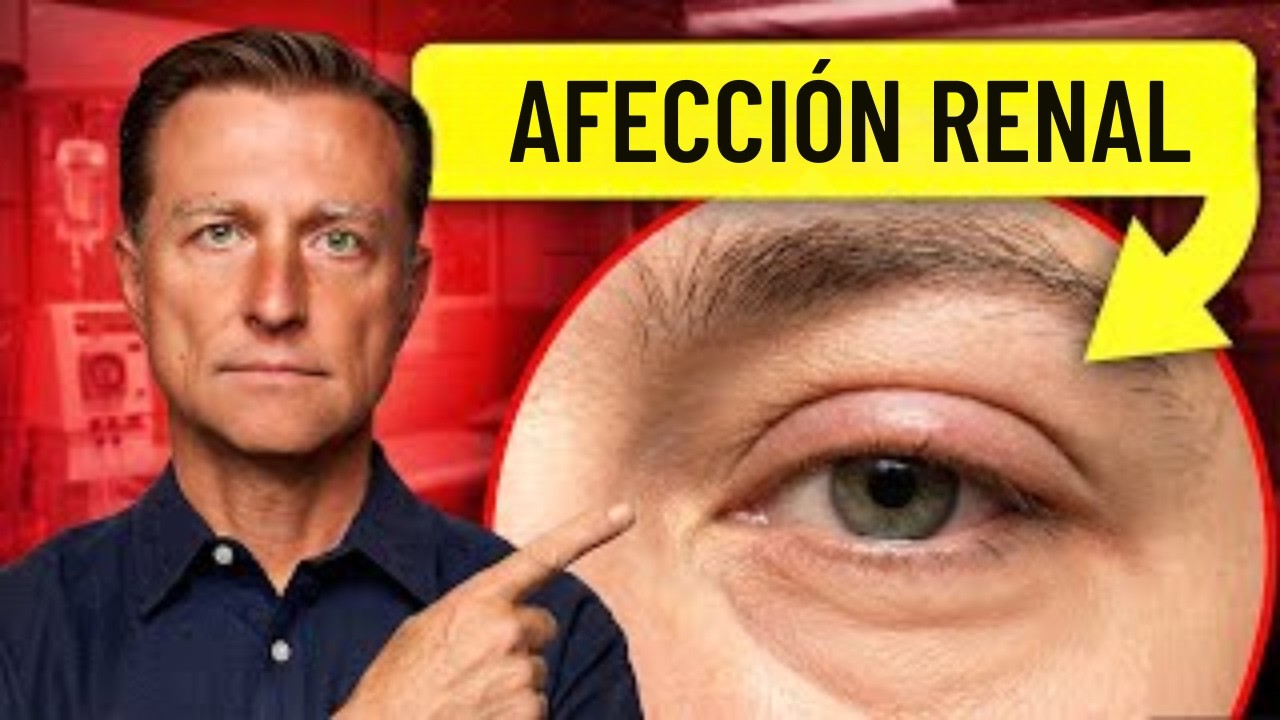 18 señales visibles de enfermedad renal que no debes ignorar