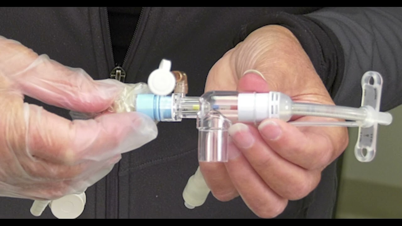 Care of the Medically Complex Child with Tracheostomy and Gastrostomy Tube – Tracheal Suctioning