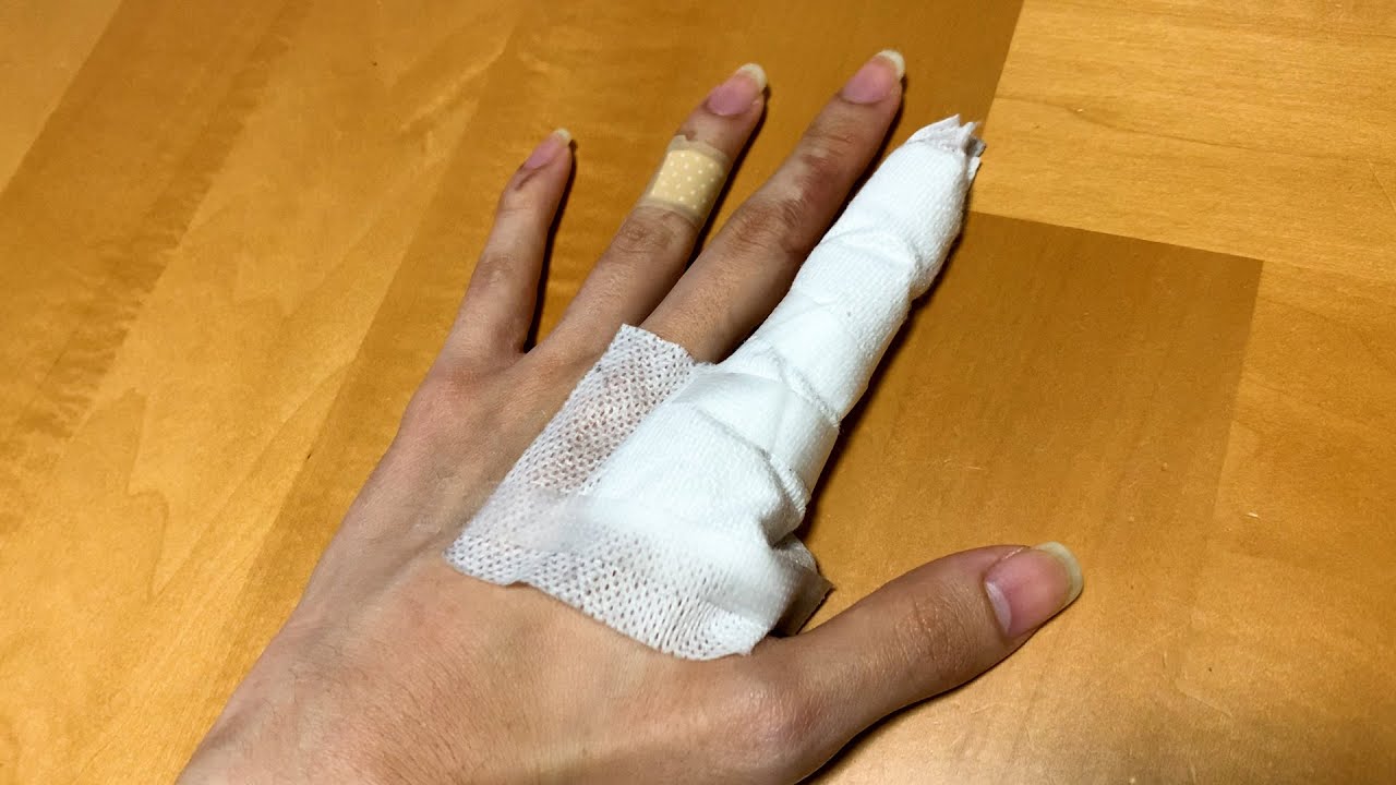大怪我しました。byチャタ