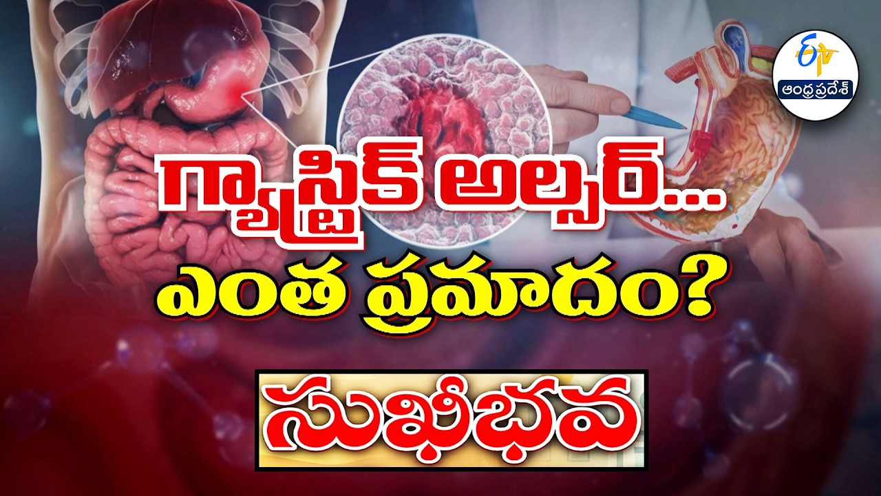గ్యాస్ట్రిక్ అల్సర్. ఎంత ప్రమాదం ? | Gastric Ulcer How Dangerous Can it be ? | Sukhibhava | ETV AP