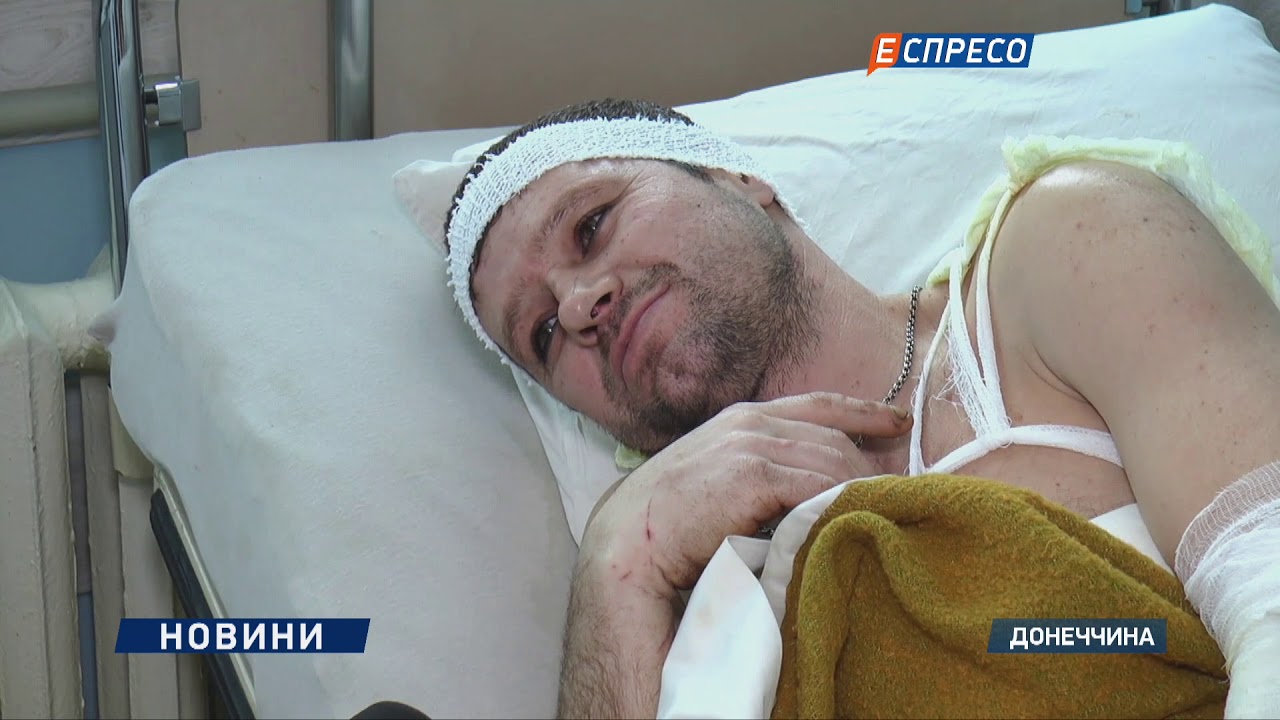 В результате возгорания метана на шахте ожоги получили 8 шахтеров