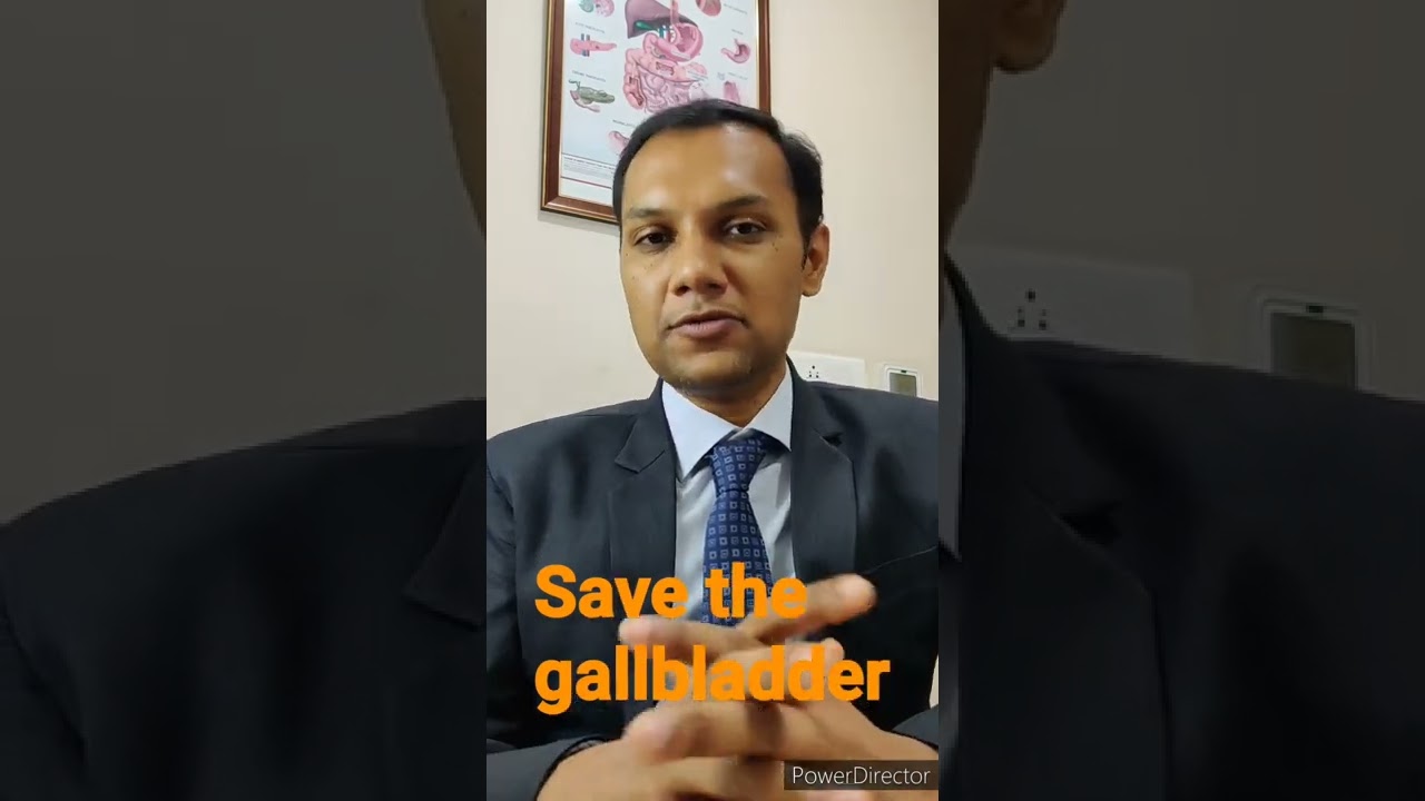 Can we remove only the stone and save the gallbladder? Best treatment for gallbladder stones