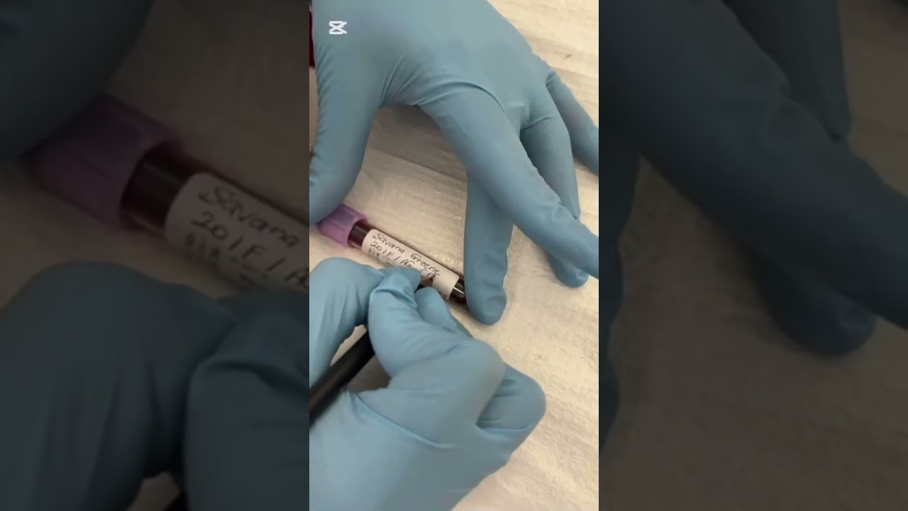 Phlebotomy project video