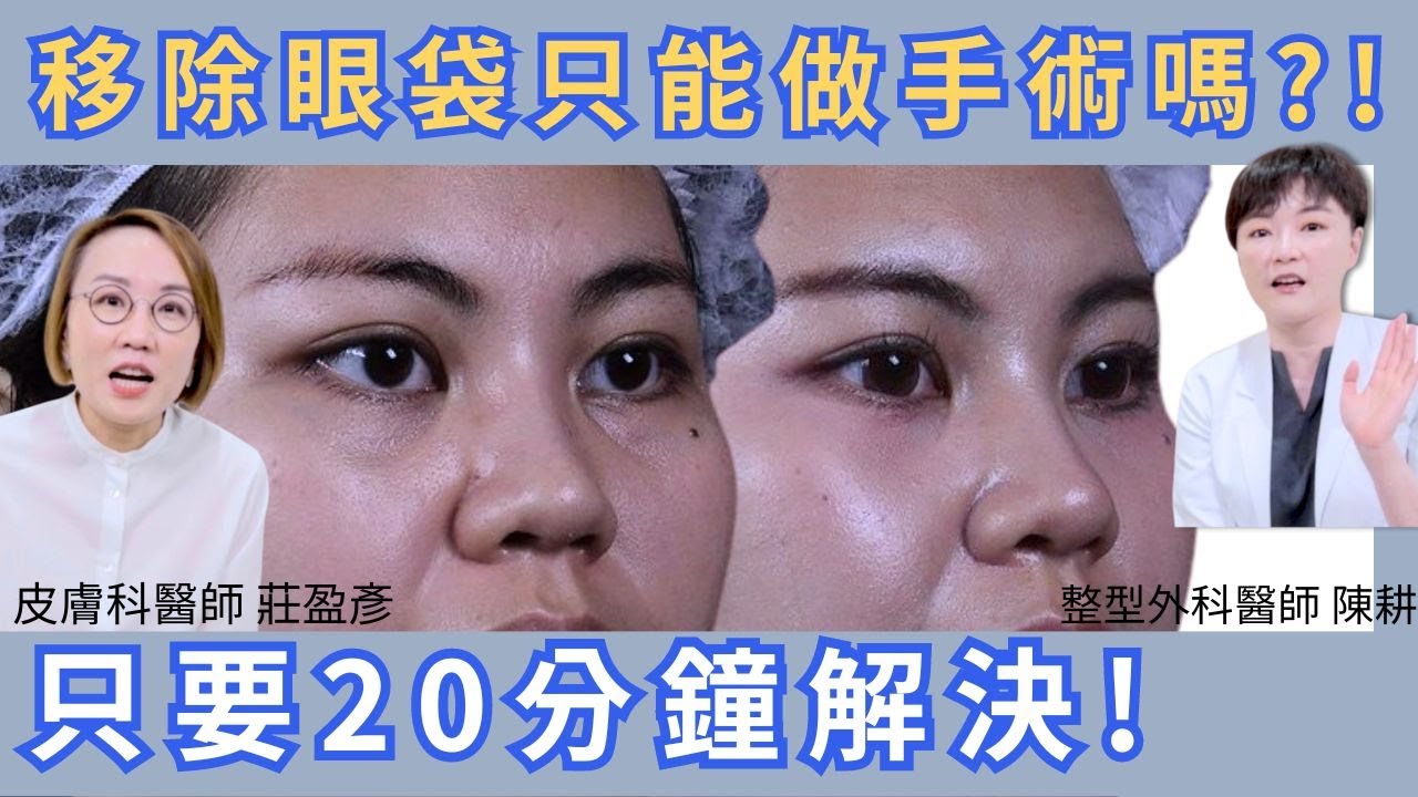 無痛移除眼袋？眼袋移除新方法！UP雷射，讓你在短時間內告別眼袋。