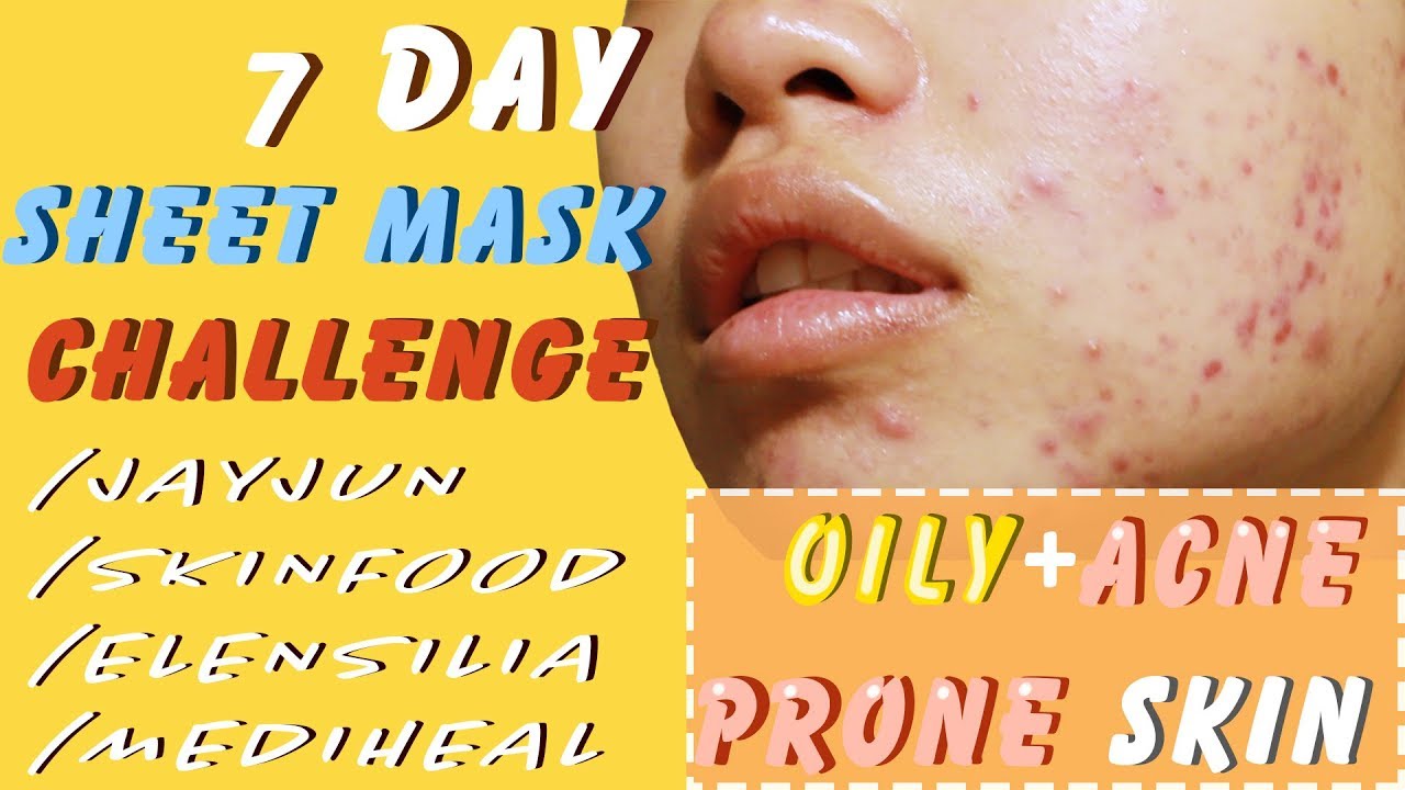 7 DAY SHEET MASK CHALLENGE on OILY+ACNE PRONE SKIN | WEEK OF SHEET MASKS EP.1