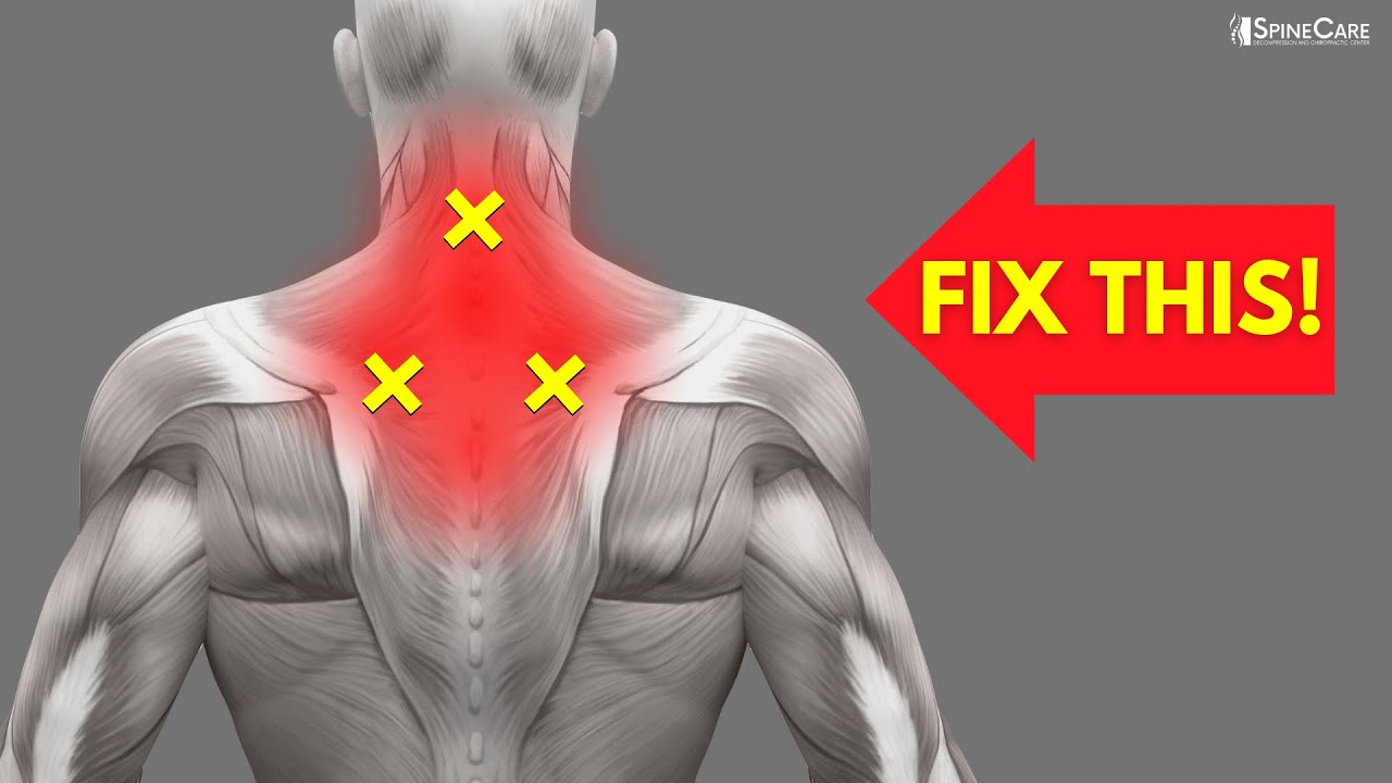 How to INSTANTLY Fix Neck and Upper Back Pain