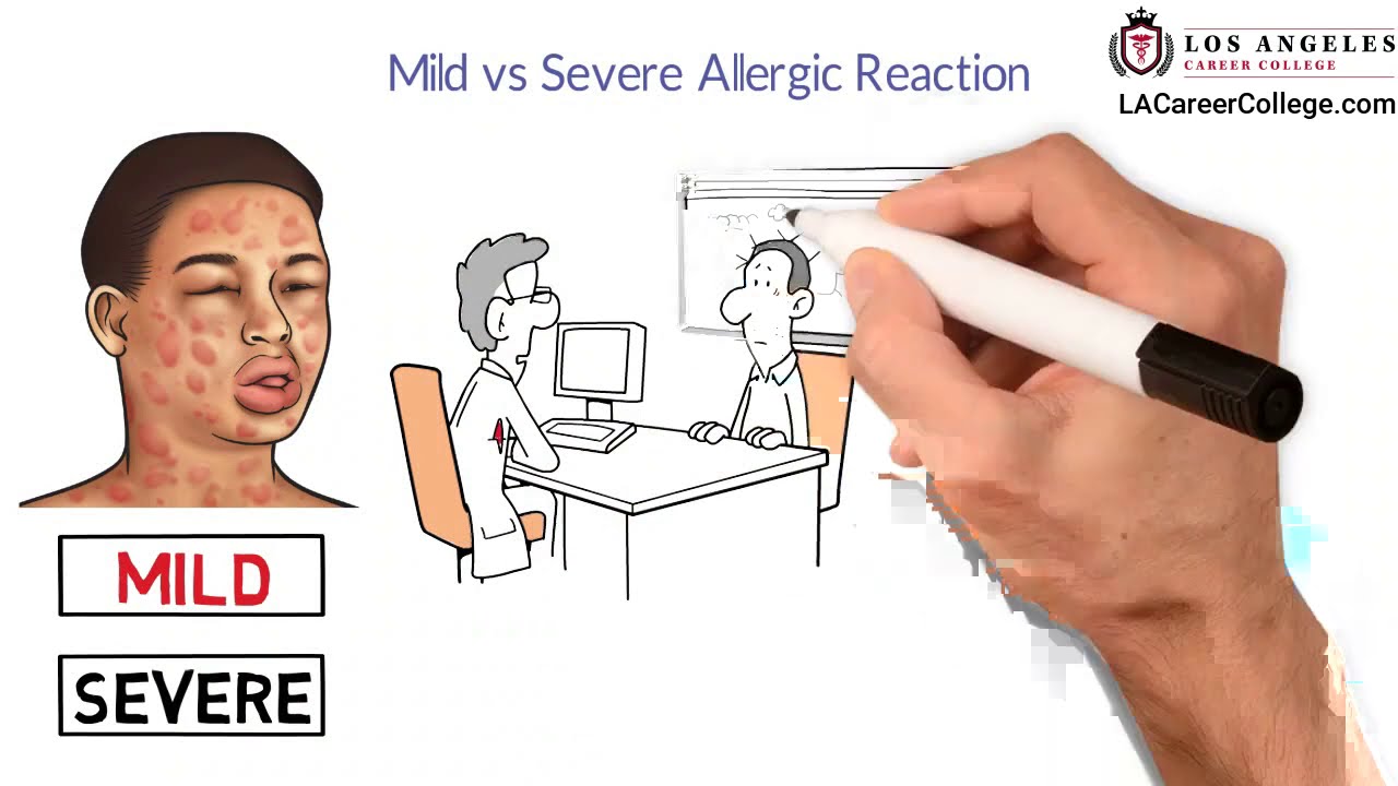 LACC | Allergic Reaction | American Heart Association