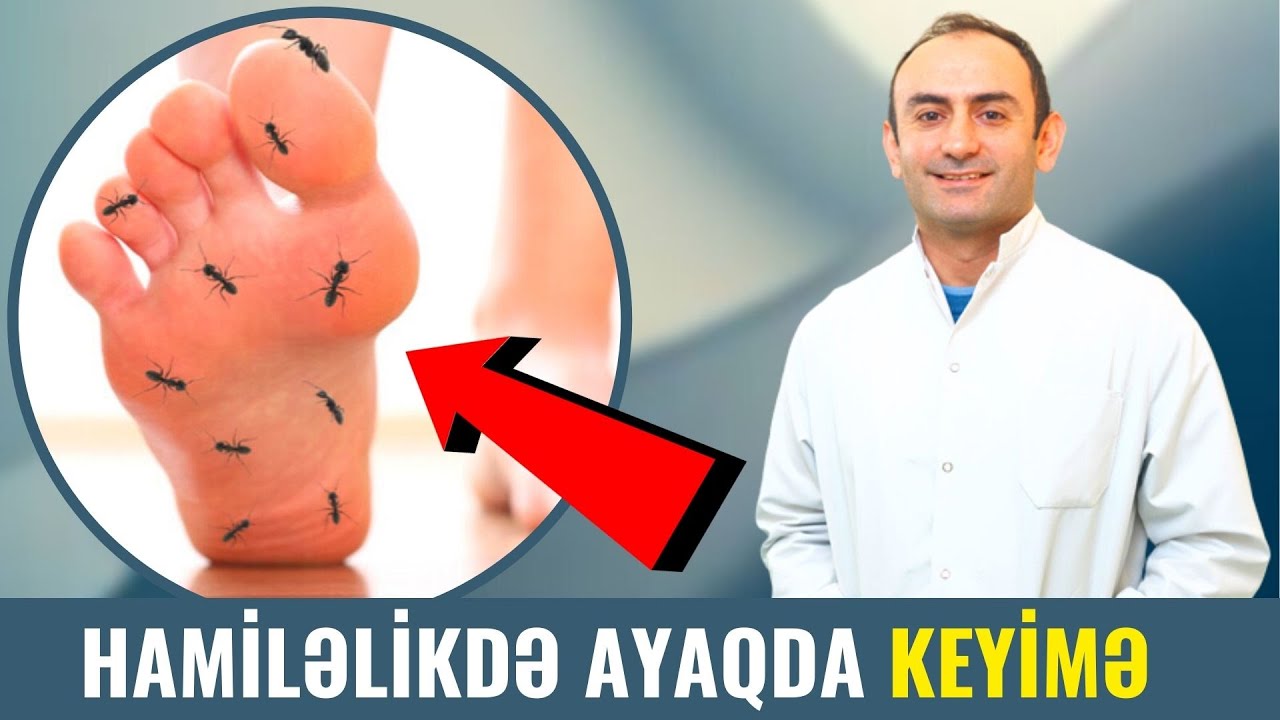 Hamilələr DİQQƏT! - BEL AYAQ Ağrılarının Səbəbi Bu İmiş