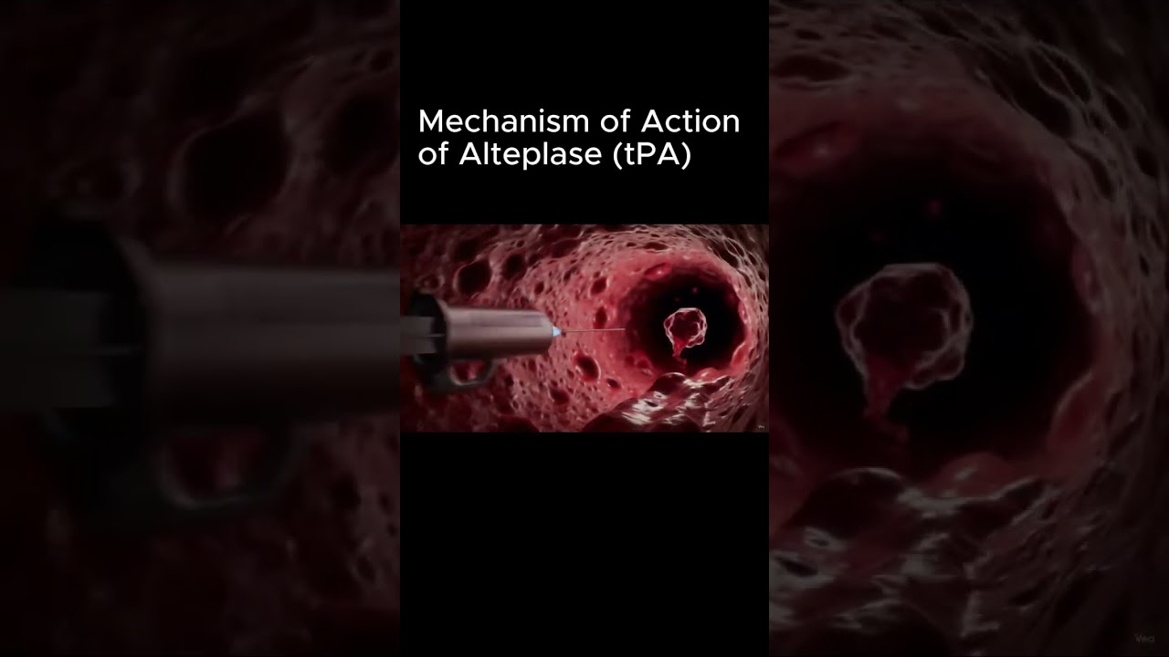 How Alteplase Works ⚡ Clot-Busting tPA Mechanism Explained in 60 Seconds! #shorts