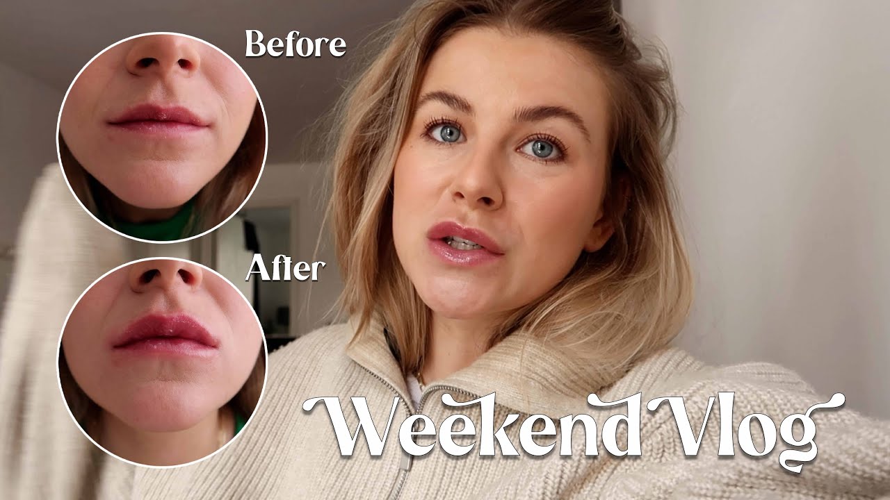 Lip fillers zonder naalden, selfcare weekend & nieuwe aankopen | Julia van Rijn