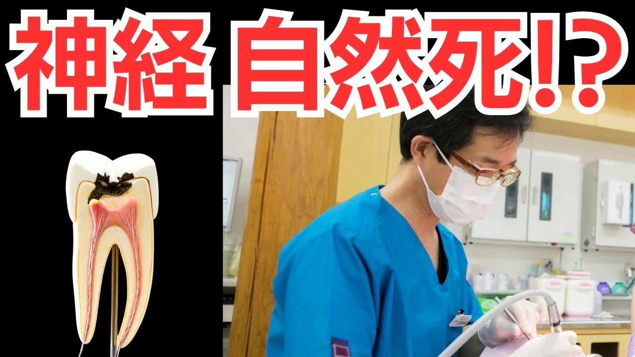 【質疑応答】神経を抜いていないのに、自然に神経が亡くなってしまうことってあるのですか？