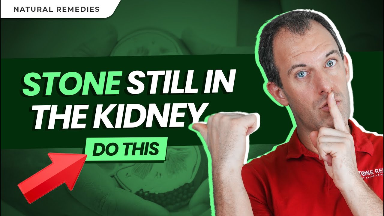 Managing Kidney Stones in the Kidney: Density, Treatments, and Prevention Tips