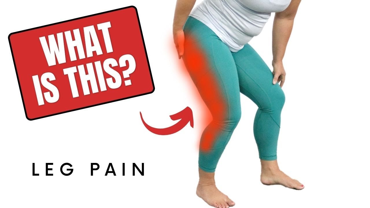 What is a Pinched Nerve in the Lumbar Spine?  - Radiculopathy 