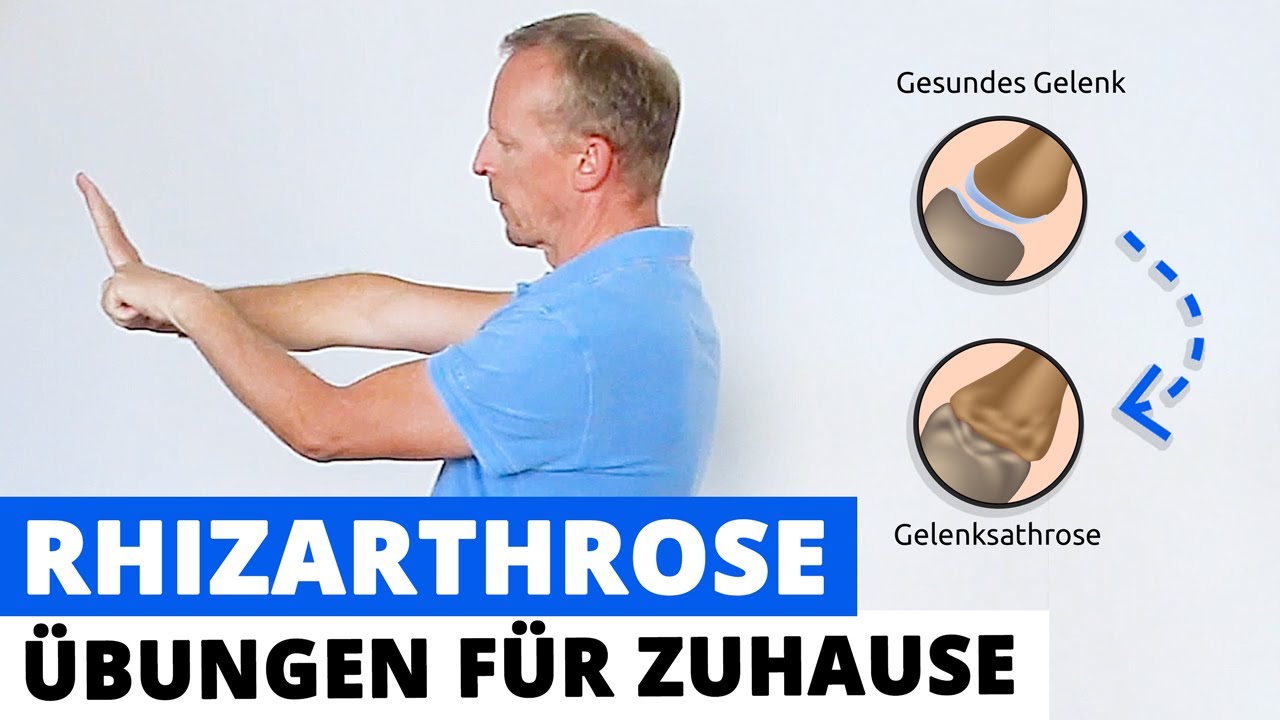Rhizarthrose / Daumenschmerzen - 3 &Uuml;bungen gegen Schmerzen (f&uuml;r zu Hause)