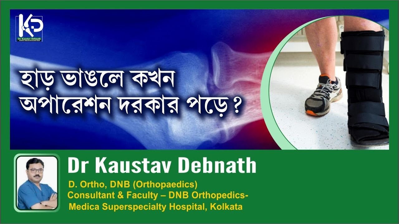 Surgical Indications of Fracture Fixation | Dr. Kaustav Debnath | Orthopedic Surgeon