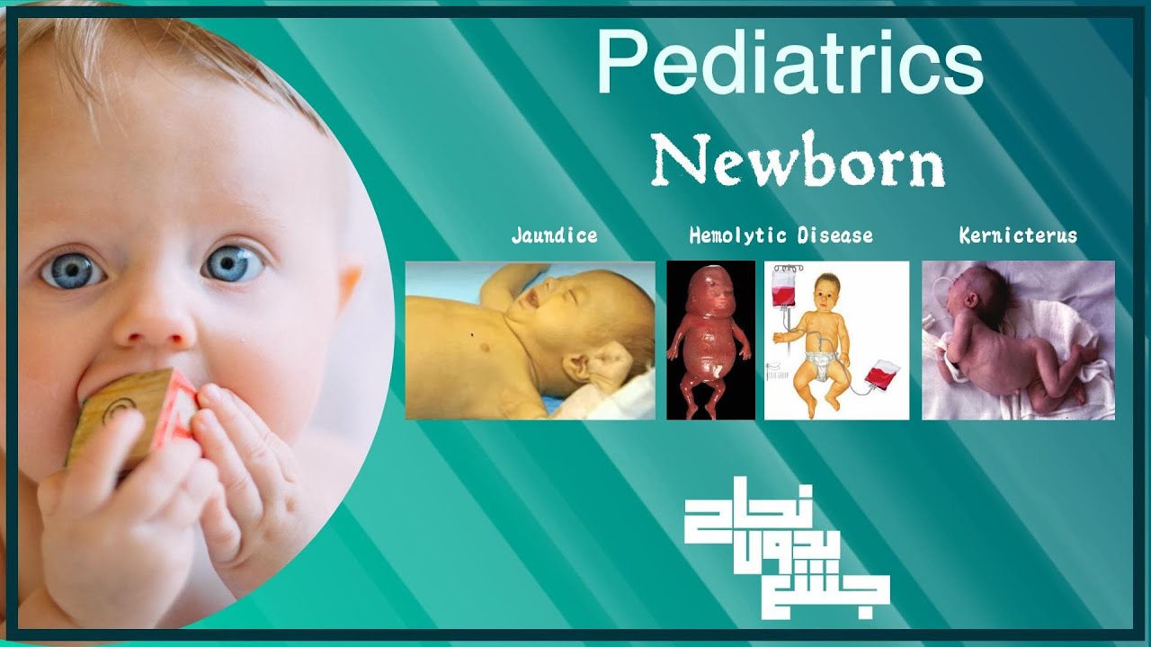 Ch1 part 4, Newborn (Jaundice) , Pediatrics