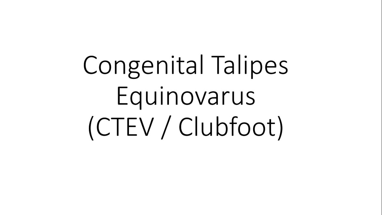 Congenital Talipes Equinovarus (CTEV / Clubfoot) - Orthopedics