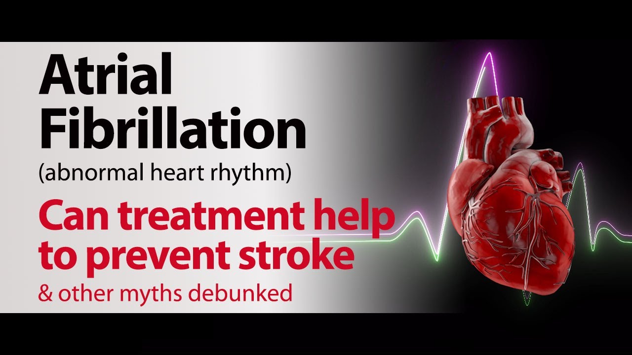 Atrial Fibrillation - Can treatment help to prevent stroke & other myths debunked