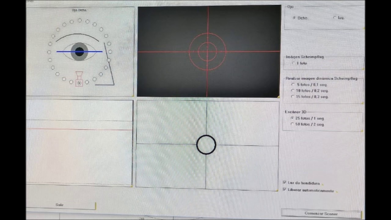 TOPÓGRAFO CORNEAL PENTACAM - OCULUS
