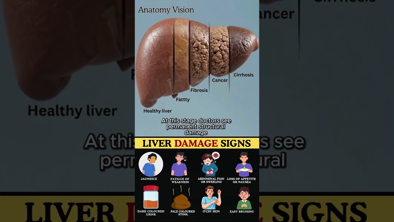 What REALLY Happens If You Ignore Liver Cancer Warning Signs