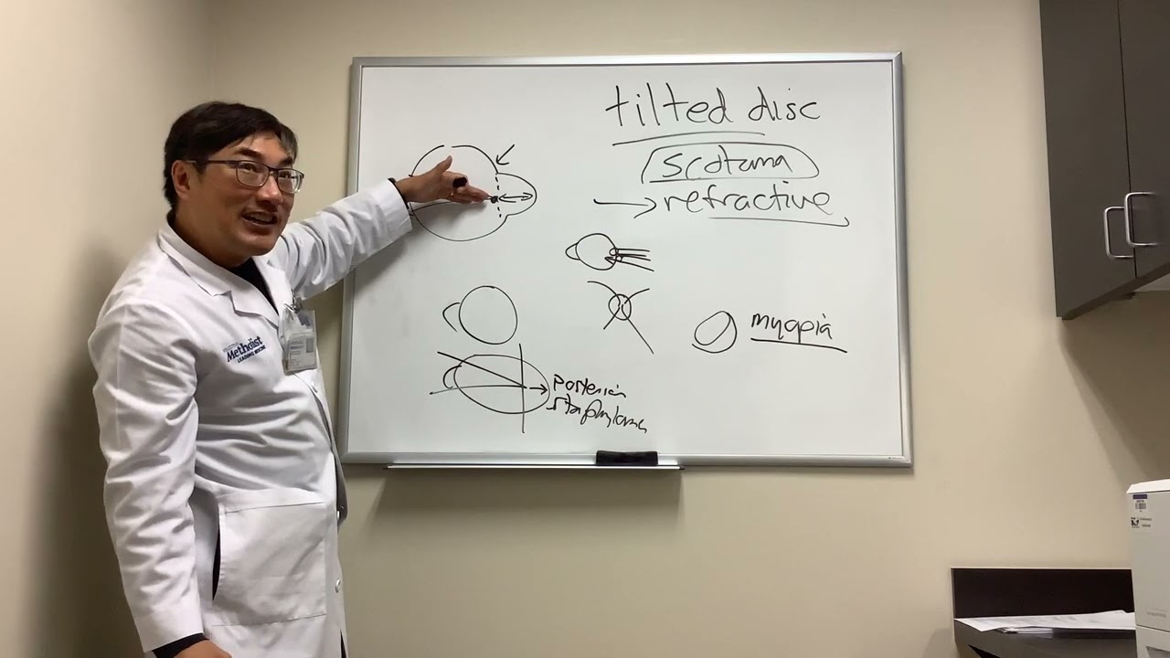 Scotoma in Tilted Disc Syndrome