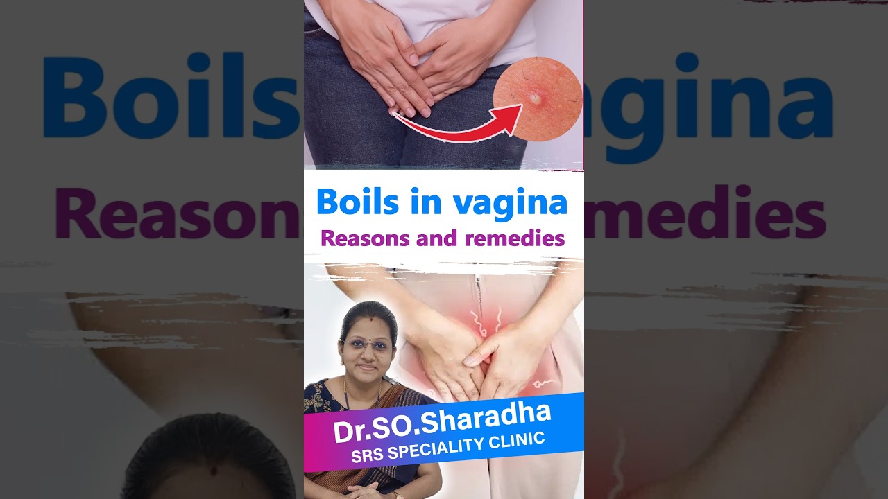 🤕👀 Vaginal Boils: Causes, Symptoms, and  Remedies! 🌿 #reasons #remedies #vaginal hygiene #hygiene