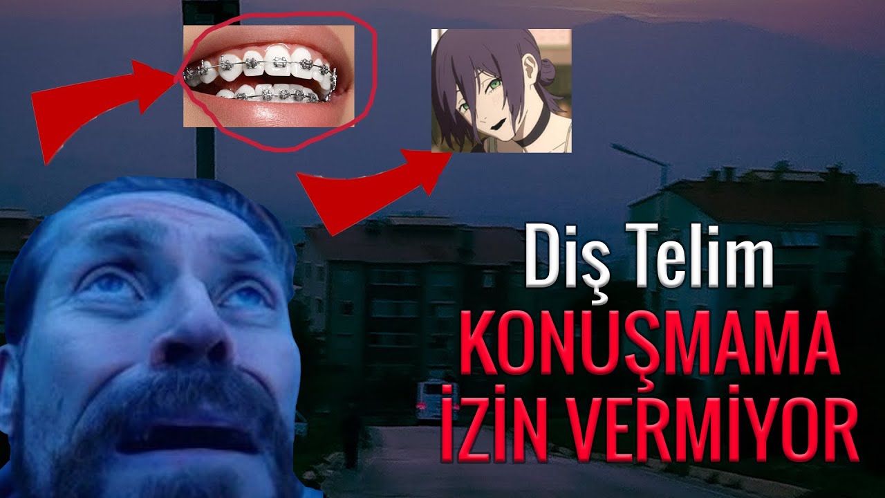 Diş Telim Konuşturmuyor - Çöpcü Abinin P*rno Arşivi