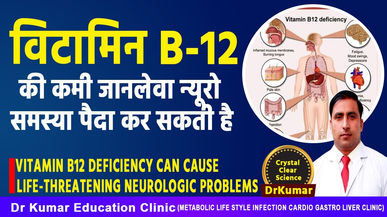 विटामिन b12 की कमी जानलेवा न्यूरो समस्या पैदा कर सकती है//Vitamin B12 deficiency can cause
