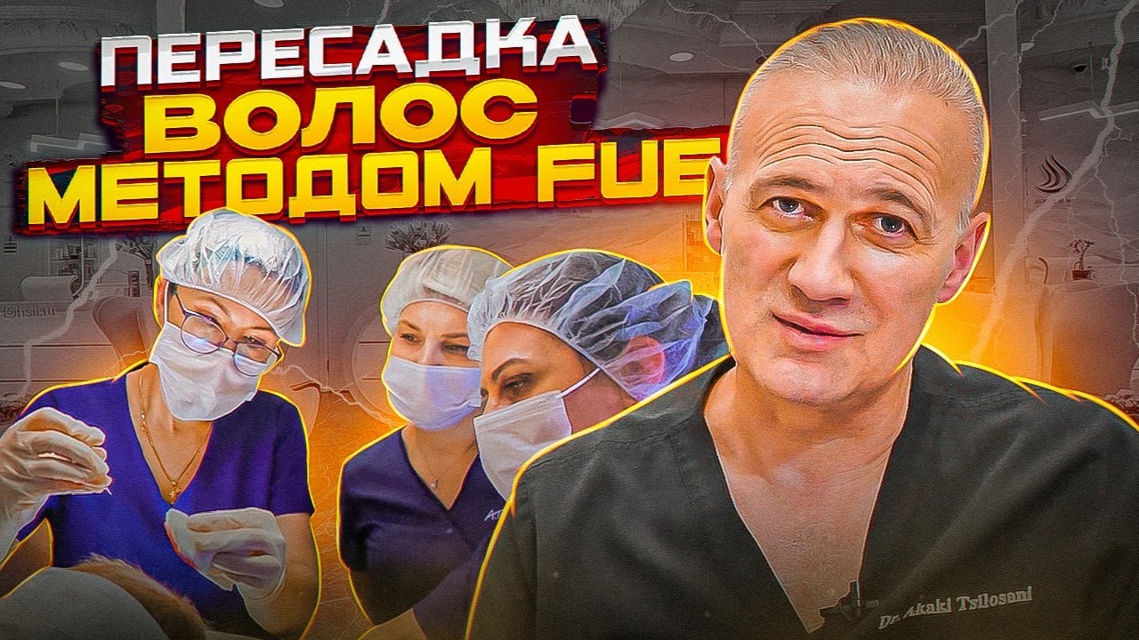 Пересадка волос методом FUE. Доктор медицинских наук Акакий Цилосани
