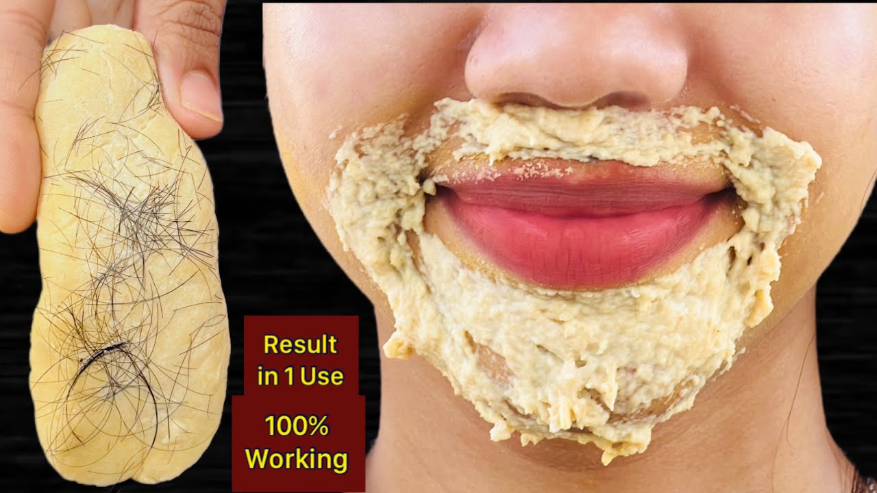 नारियल तेल में ये मिलाकर लगाने से अनचाहे बालों से छुटकारा मिलेगा Remove Facial hair permanently