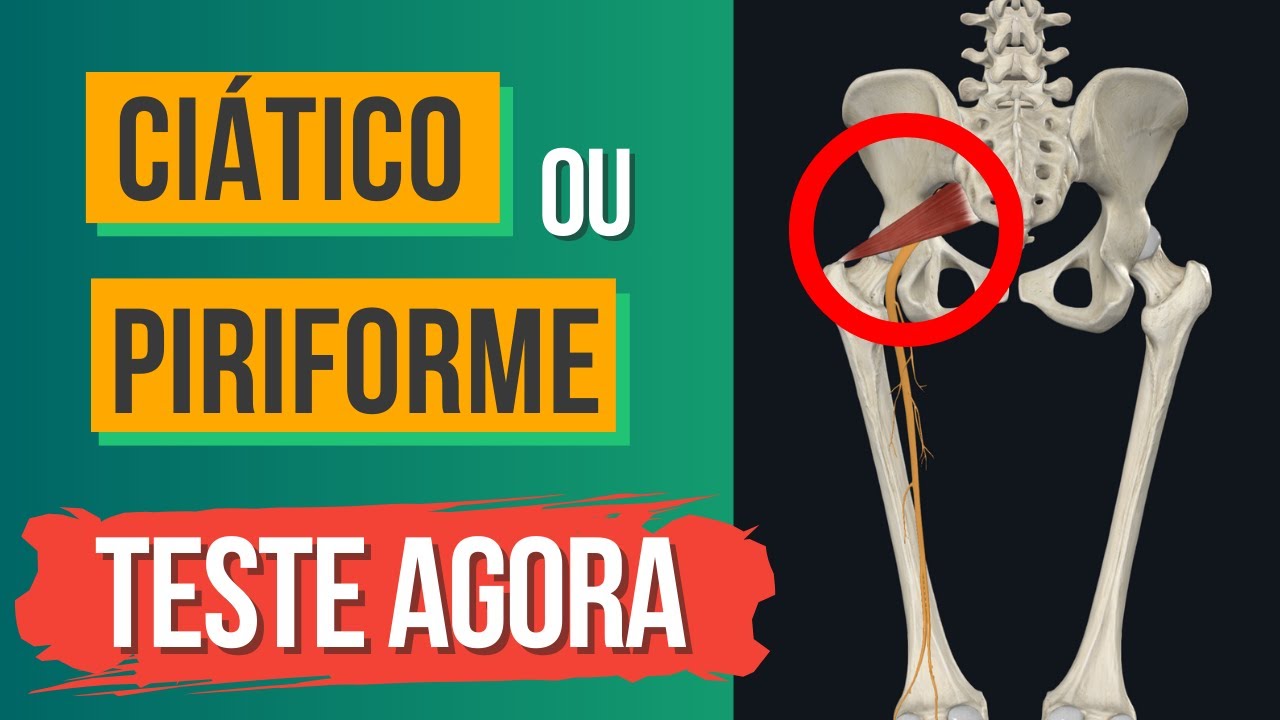 Como saber se o CI&Aacute;TICO est&aacute; Inflamado &ndash; Teste r&aacute;pido