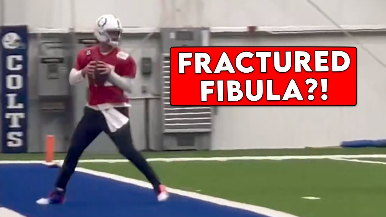 Daniel Jones złamał kość strzałkową i chce grać pomimo b&oacute;lu &ndash; wyjaśnia lekarz