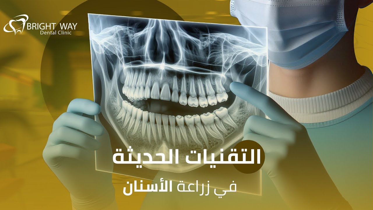 التقنيات الحديثة في زراعة الأسنان