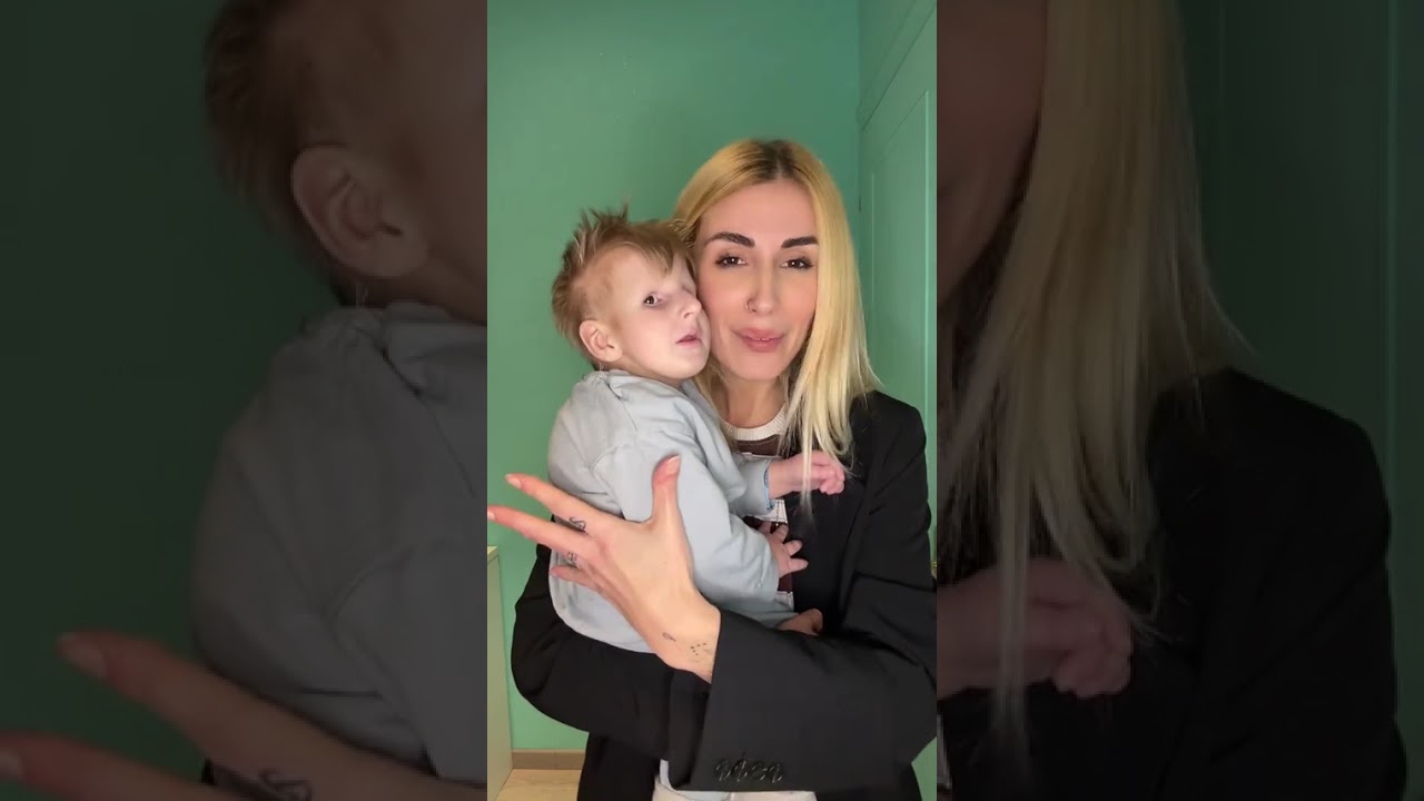 #cockaynesyndromeawareness#cockayne #syndrome 