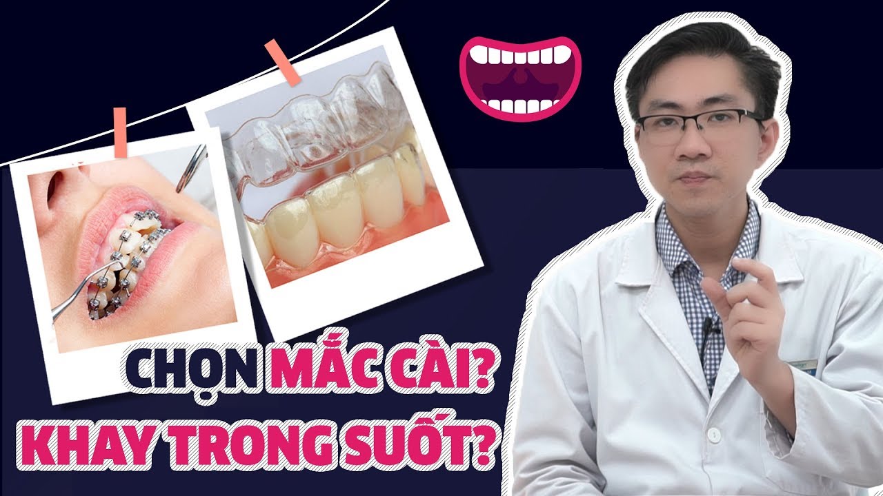 Nên Lựa Chọn Niềng Răng Mắc Cài Hay Khay Niềng Răng Trong Suốt Vinalign? | Nam Bui Vinalign