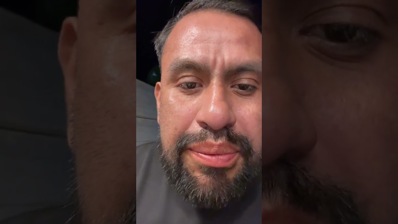 Changoleon fue a comer hotdog con el Rambo y el macunba y el varillas y el Larry cl&iacute;nica jireh 