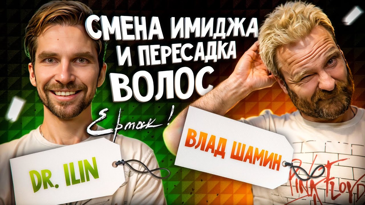 Пересадка волос у вокалиста группы Ермак! Подкаст| Влад Шамин| Матвей Ильин