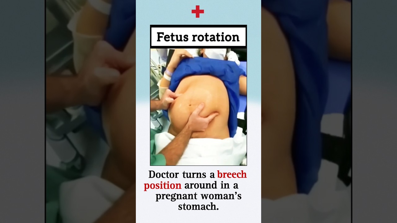 Fetus rotation 